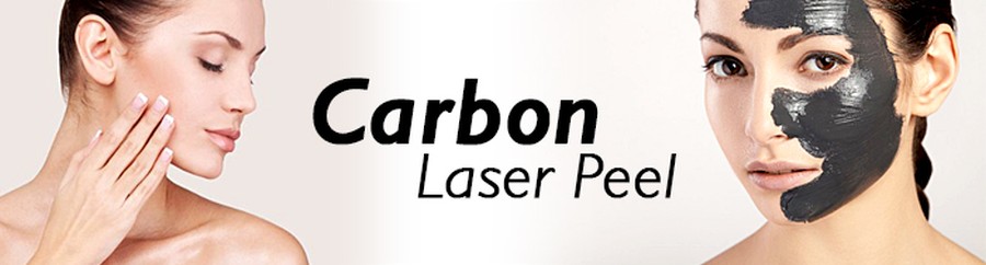 carbon-peel-kezeles-1